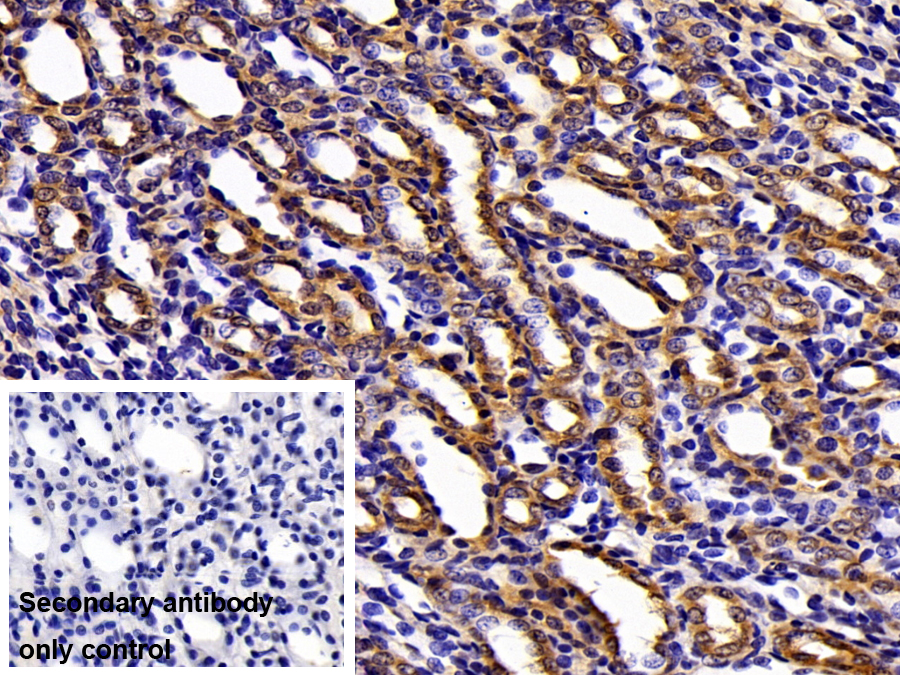 Polyclonal Antibody to Catechol-O-Methyltransferase (COMT)