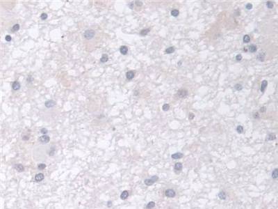 Polyclonal Antibody to Chitinase 3 Like Protein 2 (CHI3L2)