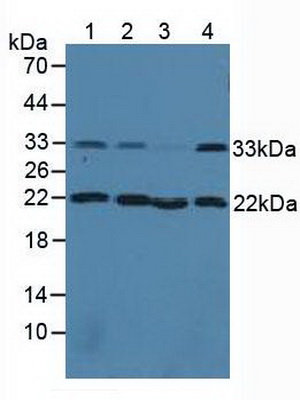 Polyclonal Antibody to Calponin 2 (CNN2)