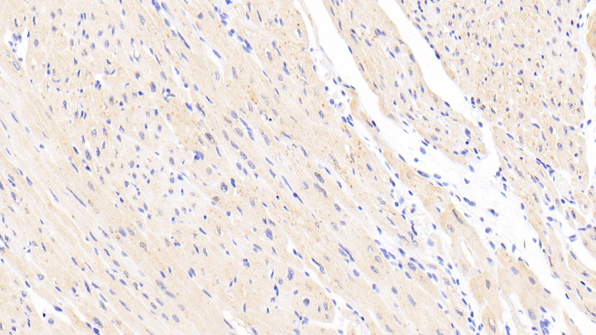 Polyclonal Antibody to Calponin 2 (CNN2)