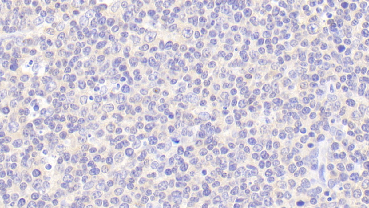 Polyclonal Antibody to Calponin 2 (CNN2)