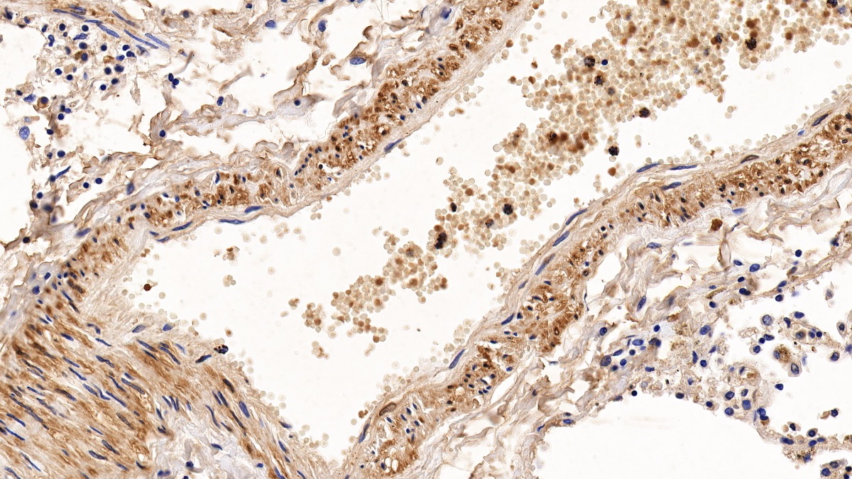 Polyclonal Antibody to Calponin 1, Basic (CNN1)