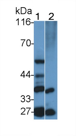 Polyclonal Antibody to Calponin 1, Basic (CNN1)