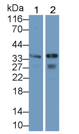 Polyclonal Antibody to Calponin 1, Basic (CNN1)