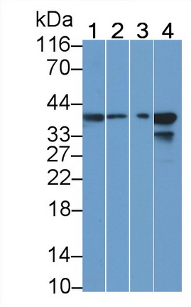 Polyclonal Antibody to Calponin 1, Basic (CNN1)