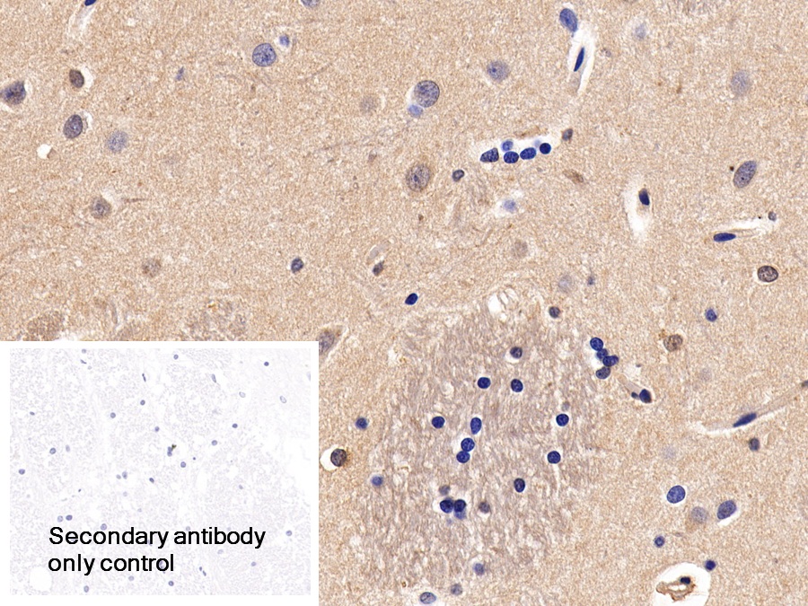 Polyclonal Antibody to Calponin 1, Basic (CNN1)