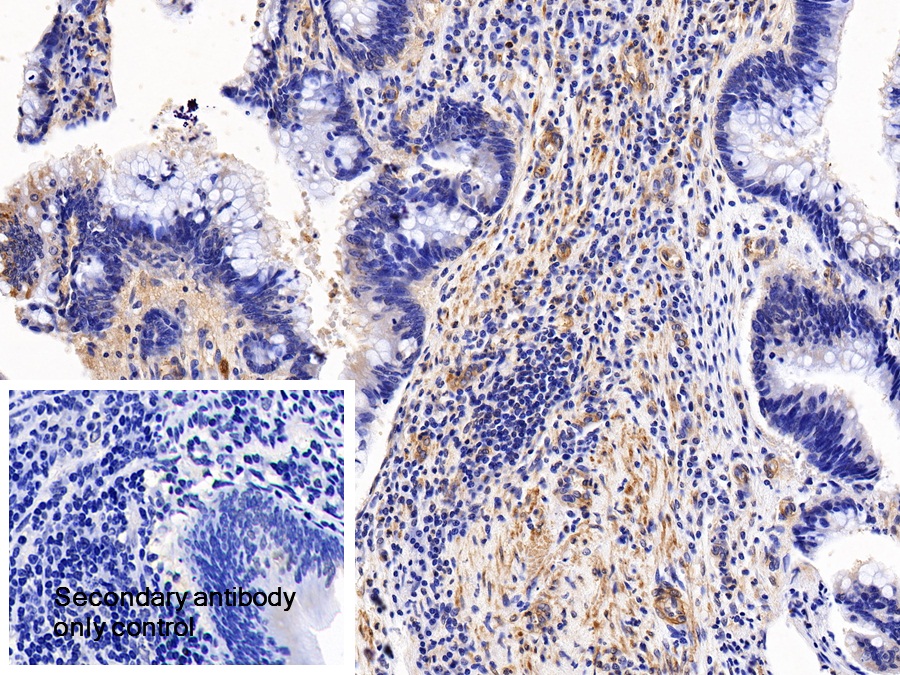 Polyclonal Antibody to Calponin 1, Basic (CNN1)