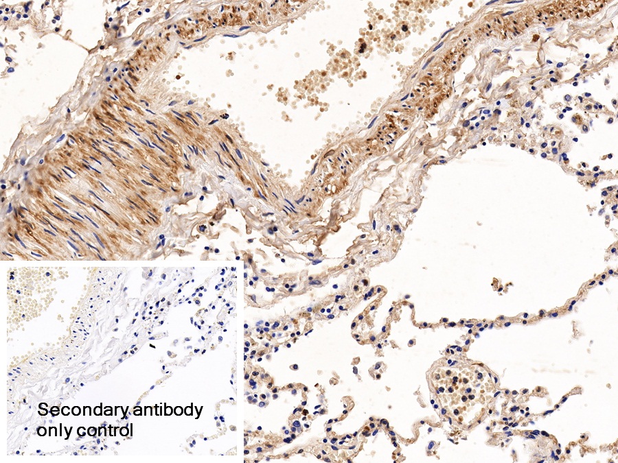 Polyclonal Antibody to Calponin 1, Basic (CNN1)