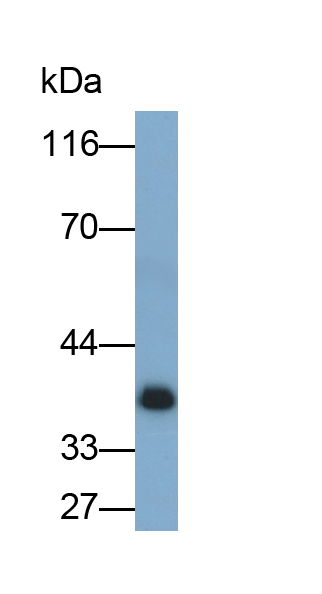 Polyclonal Antibody to Ceramide Kinase (CERK)