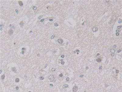 Polyclonal Antibody to Lactamase Beta (LACTb)