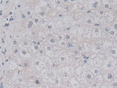 Polyclonal Antibody to Lactamase Beta (LACTb)