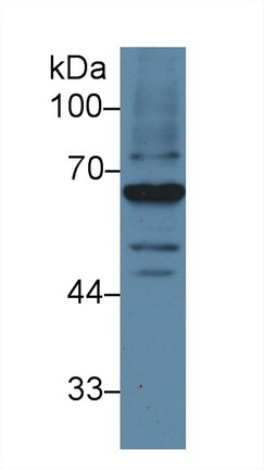 Polyclonal Antibody to Lecithin Cholesterol Acyltransferase (LCAT)