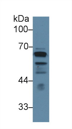 Polyclonal Antibody to Lecithin Cholesterol Acyltransferase (LCAT)