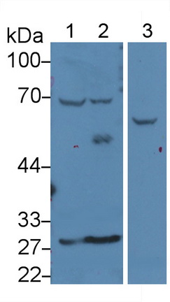 Polyclonal Antibody to Lecithin Cholesterol Acyltransferase (LCAT)