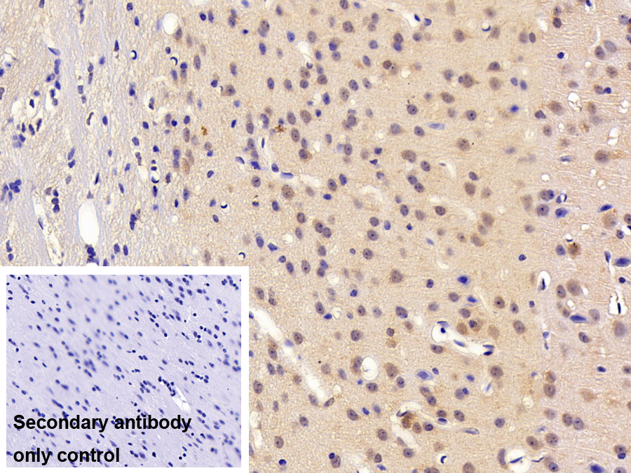 Polyclonal Antibody to Dishevelled, Dsh Homolog 1 (DVL1)