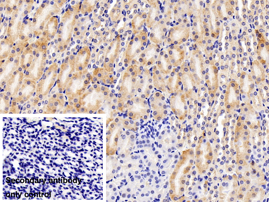 Polyclonal Antibody to Dishevelled, Dsh Homolog 1 (DVL1)