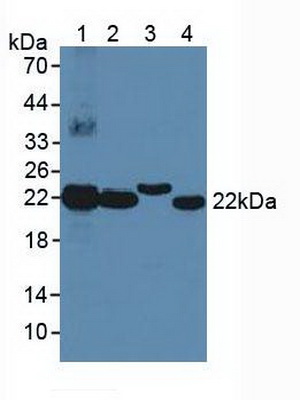 Polyclonal Antibody to Biliverdin Reductase B (BLVRB)