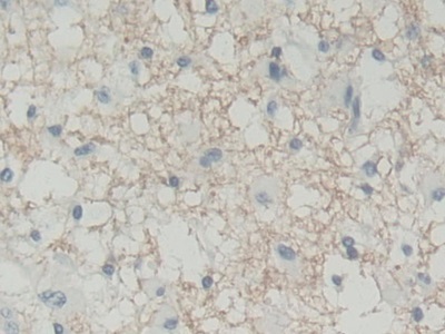 Polyclonal Antibody to Biliverdin Reductase B (BLVRB)