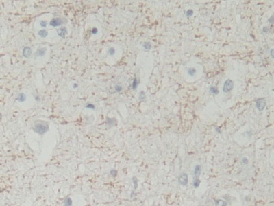 Polyclonal Antibody to Biliverdin Reductase B (BLVRB)