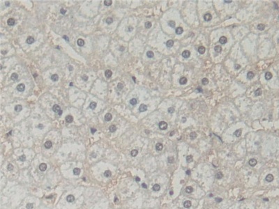 Polyclonal Antibody to Biliverdin Reductase B (BLVRB)