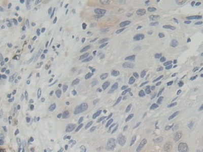 Polyclonal Antibody to Biliverdin Reductase B (BLVRB)