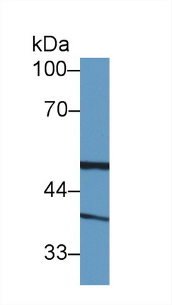 Polyclonal Antibody to Biliverdin Reductase A (BLVRA)