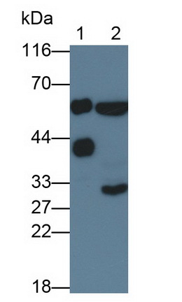 Polyclonal Antibody to Biliverdin Reductase A (BLVRA)