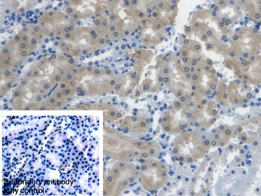 Polyclonal Antibody to Biliverdin Reductase A (BLVRA)