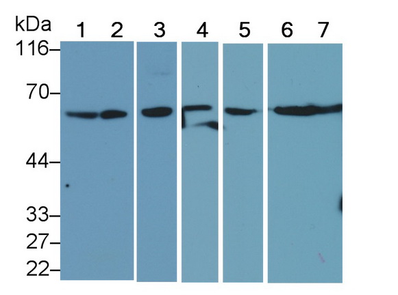 Polyclonal Antibody to Beclin 1 (BECN1)