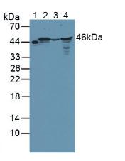 Polyclonal Antibody to Branched Chain Alpha-Ketoacid Dehydrogenase Kinase (BCKDK)