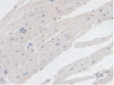 Polyclonal Antibody to Branched Chain Alpha-Ketoacid Dehydrogenase Kinase (BCKDK)