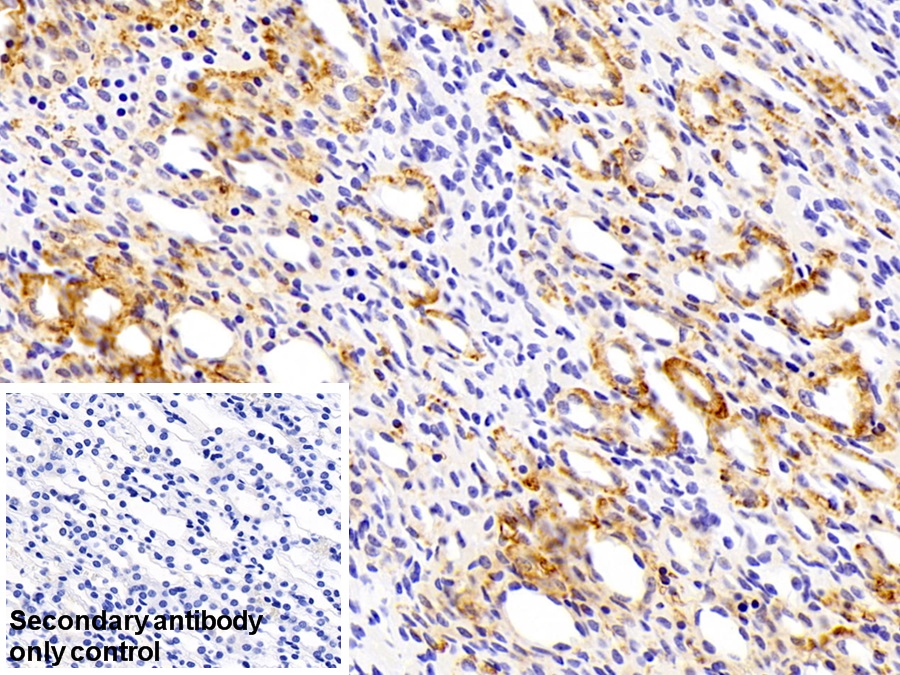 Polyclonal Antibody to Branched Chain Alpha-Ketoacid Dehydrogenase Kinase (BCKDK)