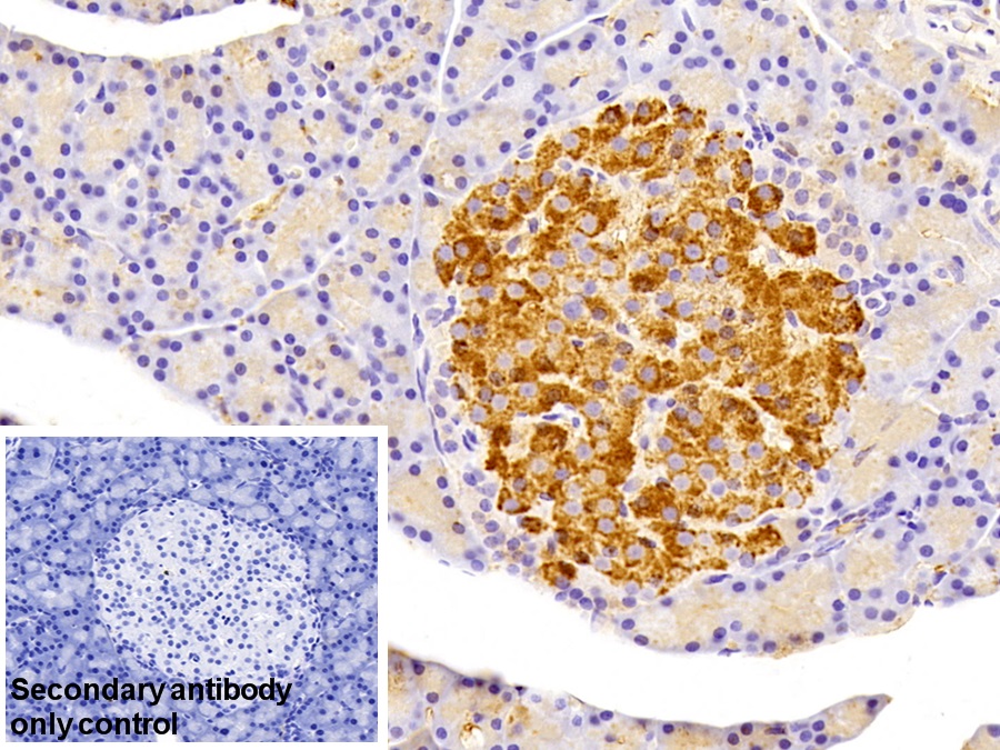 Polyclonal Antibody to Branched Chain Alpha-Ketoacid Dehydrogenase Kinase (BCKDK)