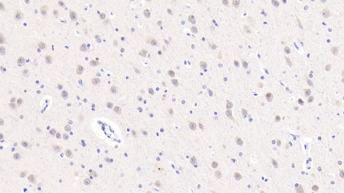 Polyclonal Antibody to Artemin (ARTN)