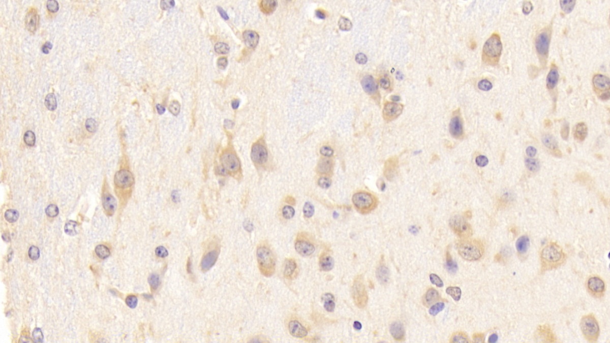 Polyclonal Antibody to Artemin (ARTN)