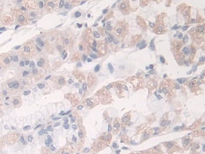 Polyclonal Antibody to Acyloxyacyl Hydrolase (AOAH)