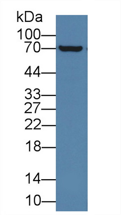 Polyclonal Antibody to Acyloxyacyl Hydrolase (AOAH)