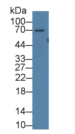 Polyclonal Antibody to Acyloxyacyl Hydrolase (AOAH)