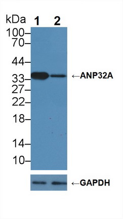 Polyclonal Antibody to Acidic Nuclear Phosphoprotein 32 Family, Member A (ANP32A)