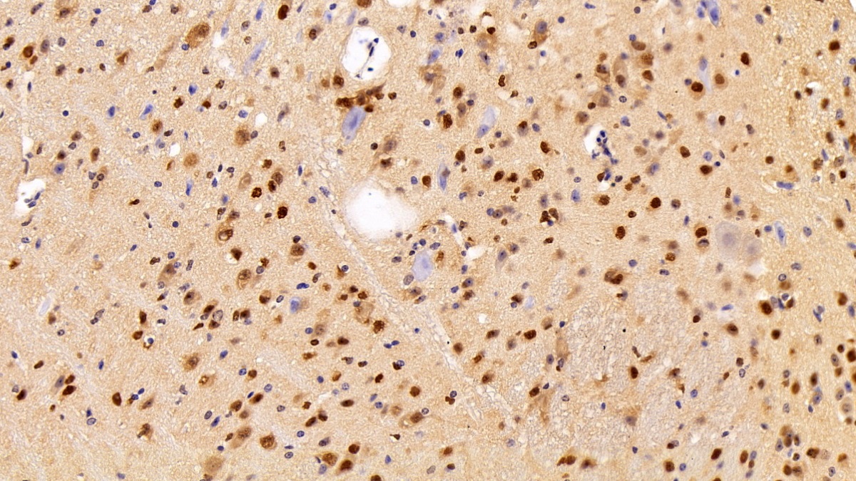 Polyclonal Antibody to Acidic Nuclear Phosphoprotein 32 Family, Member A (ANP32A)