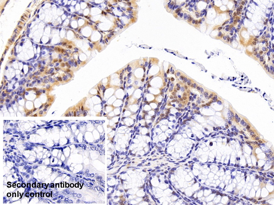 Polyclonal Antibody to Acidic Nuclear Phosphoprotein 32 Family, Member A (ANP32A)