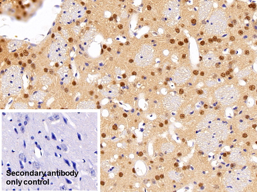 Polyclonal Antibody to Acidic Nuclear Phosphoprotein 32 Family, Member A (ANP32A)