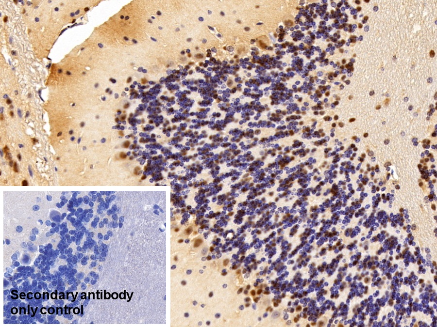 Polyclonal Antibody to Acidic Nuclear Phosphoprotein 32 Family, Member A (ANP32A)