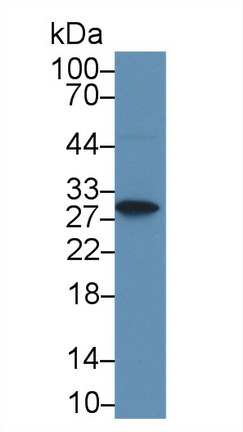 Polyclonal Antibody to Acidic Nuclear Phosphoprotein 32 Family, Member A (ANP32A)