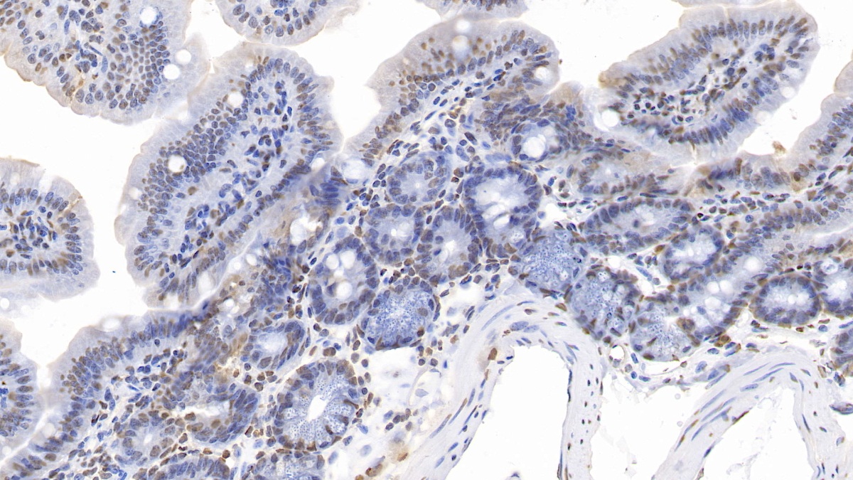 Polyclonal Antibody to Acidic Nuclear Phosphoprotein 32 Family, Member A (ANP32A)