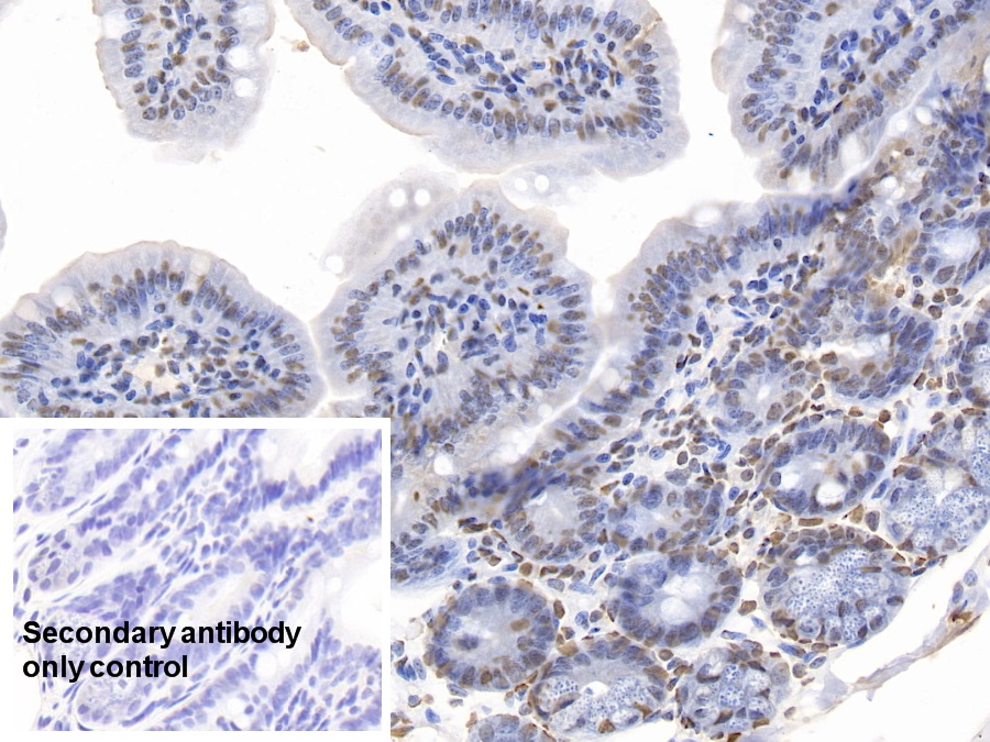 Polyclonal Antibody to Acidic Nuclear Phosphoprotein 32 Family, Member A (ANP32A)