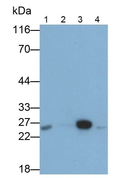 Polyclonal Antibody to Acidic Nuclear Phosphoprotein 32 Family, Member A (ANP32A)