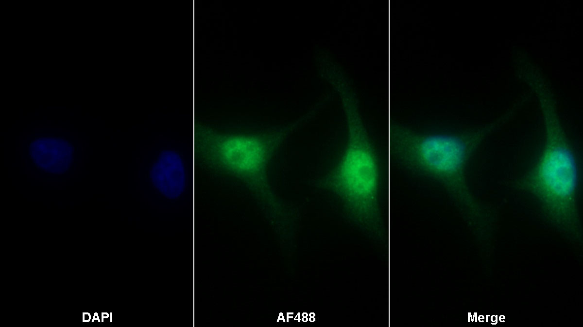 Polyclonal Antibody to Anillin (ANLN)