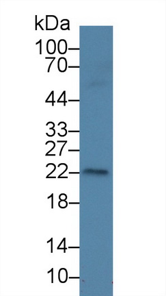 Polyclonal Antibody to Amelogenin, X-Linked (AMELX)