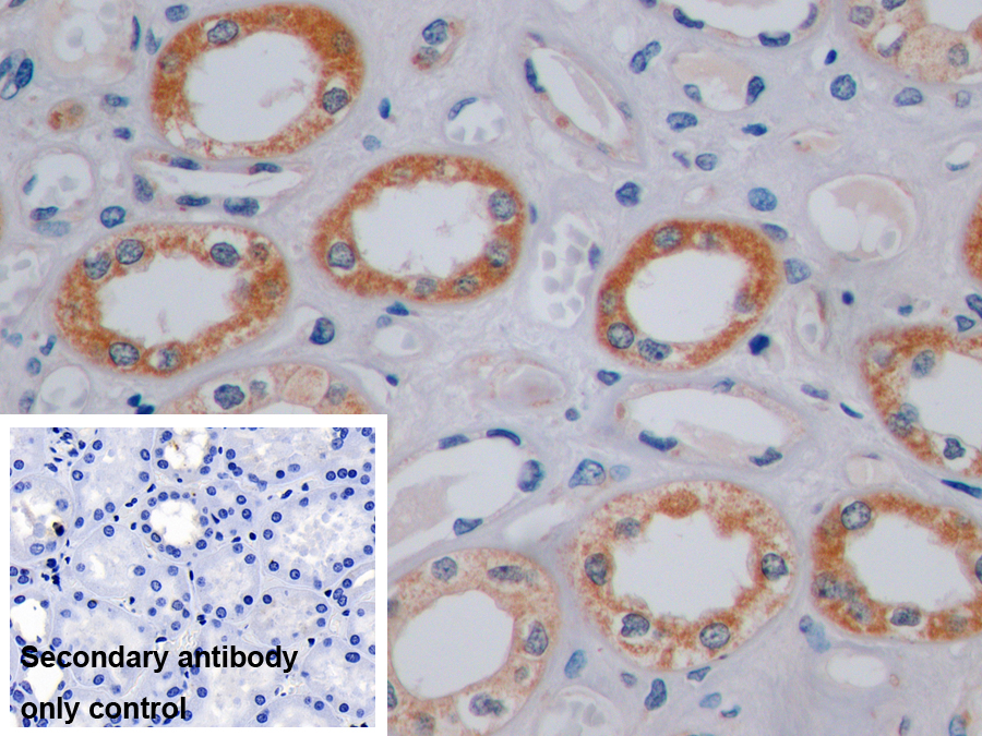 Polyclonal Antibody to Alpha-Methylacyl Coenzyme A Racemase (aMACR)